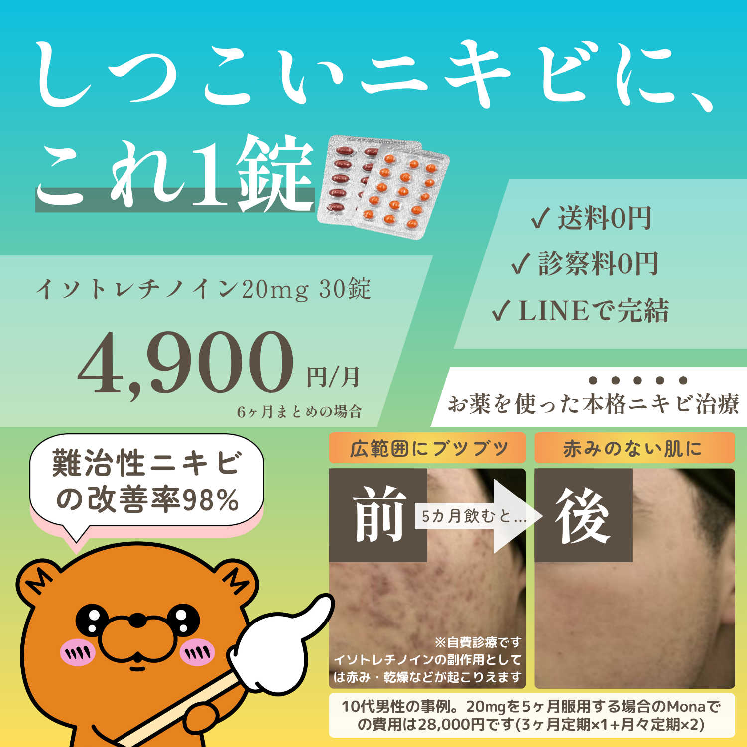 イソトレチノインの無料相談